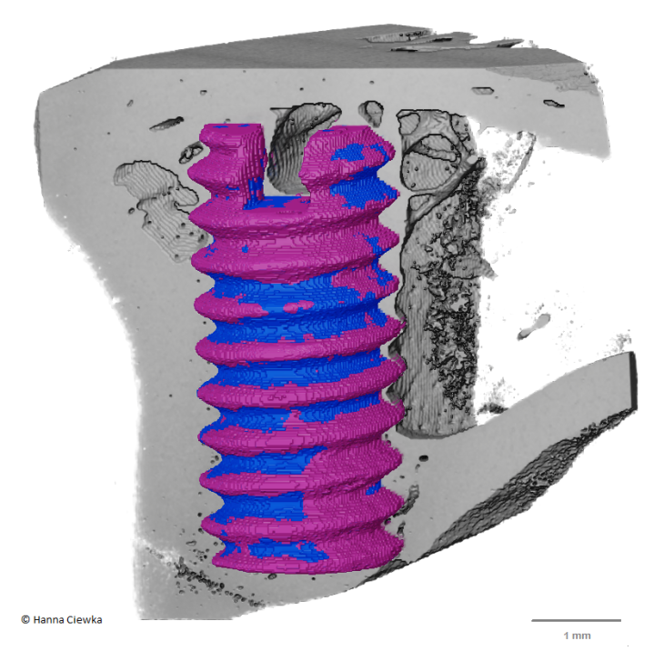 MgSafe screw rendering Hanna